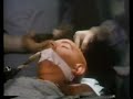 Patient #29 Patient #29