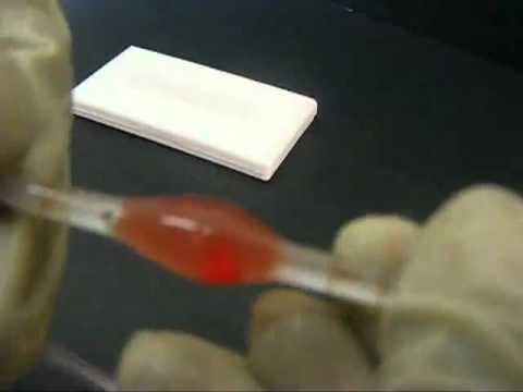 how to perform rbc count