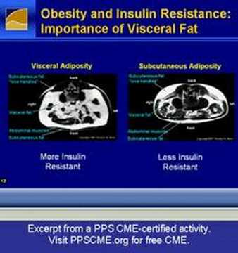 NDEI PPS--Obesity and insulin ...