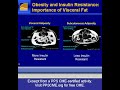 NDEI PPS--Obesity and insulin resistance--importance of visc NDEI PPS--Obesity and insulin resistance--importance of visc