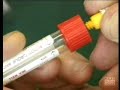 Prep for Venepuncture