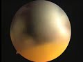 arthroscopic AC joint reconstruction ???????? ??????? ??????????????? arthroscopic AC joint reconstruction ???????? ??????? ???????????????
