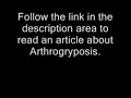 An Article About Arthrogryposis