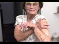 Auto-Hemoterapia Demonstração_18 Auto-Hemoterapia Demonstração_18