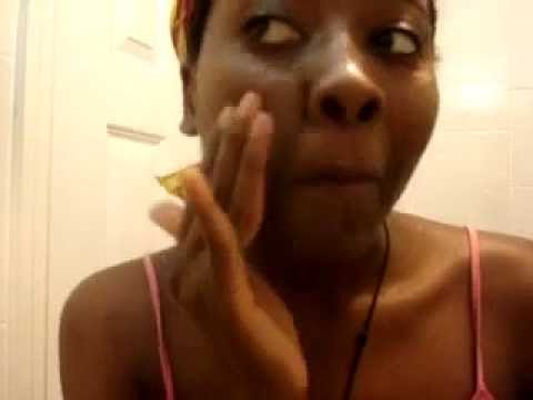 how to use vitamin e capsules for acne