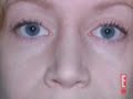 rhinoplasty-specialist-new-york-city.html
