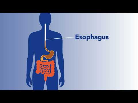 Esophageal pH Study