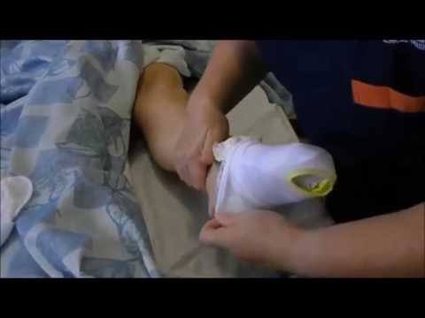 Vớ y khoa của mỹ - Cách chữa suy giãn tĩnh mạch chân 