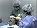 Los Angeles Hair Restoration - Dr. Rawnsley 2