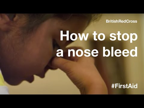 how to stop severe nose bleed