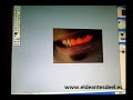 No-Tutorial como blanquear dientes con Photoshop