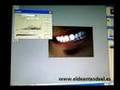 No-Tutorial como blanquear dientes con Photoshop
