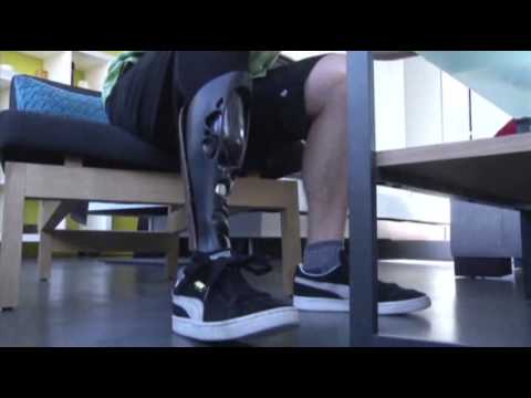 New Technology Lets Amputees Design Legs