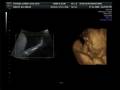 Ikutegbe Jnr 4D.mpg