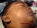 Five year old dies after years of torture and abuse