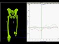 3D Running Analysis with Explanations