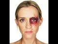 Marcas en la piel: By BrOCk Marcas en la piel: By BrOCk