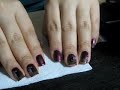 Konadicure Tornasol usando los platos M36 y M39