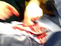 Dog surgery Dog surgery