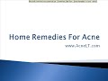 Home Remedies For Acne
