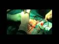 A case of complex facial trauma (PLASTIC SURGERY)