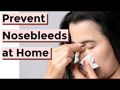 how to stop severe nose bleed