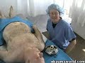 Coroner Pranked during Autopsy