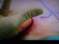 Teen Transsexual