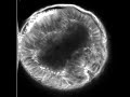 Drosophila ventral furrow formation