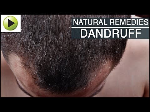 how to control dandruff at home