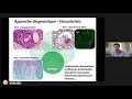 Click to View : Pr. Terrier - Les vascularites c'est quoi ? La recherche on en est où ?
