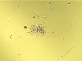 Rotifer Brachionus quadridentatus