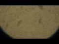 Giardia