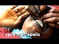 Tattooing of gums in... View Video