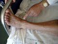 Exploracion isquemia arterial miembros inferiores