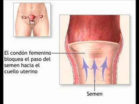 Imagen de previsualización de YouTube