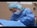 Dr. Julie Voss performs Chin Liposuction in Kirkland, WA