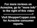 Acnezine Review | Treatments For Acne | Reviews on Revitol