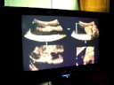 Ultrasound_4D_Video 2_Centro Radiologico Siglo XXI