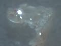 Morgellons Blood Sucking tentacles are alive