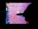Trauma Center X2: Deftera with two styli