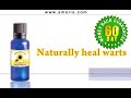 Warts Treatment, Wart Removal
