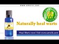 Warts Treatment, Wart Removal