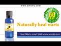 Warts Treatment, Wart Removal