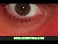 Photoshop Basics#7 Skin Touch Up Remove Wrinkles Mini-Maker