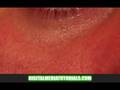 Photoshop Basics#7 Skin Touch Up Remove Wrinkles Mini-Maker