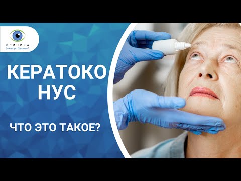 Кератоконус -  что это за болезнь? Причины, симптомы и лечение!