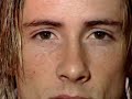 Fernando Torres