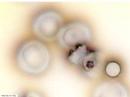 Mefloquine 15 min Mefloquine
