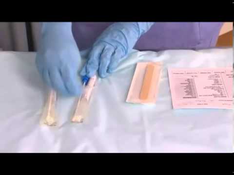 how to collect stool sample for c&s